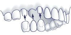 Dental Surgery